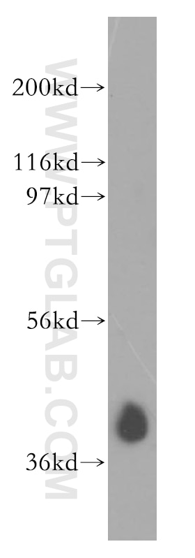 Western Blot (WB) analysis of K-562 cells using AUP1 Polyclonal antibody (13726-1-AP)