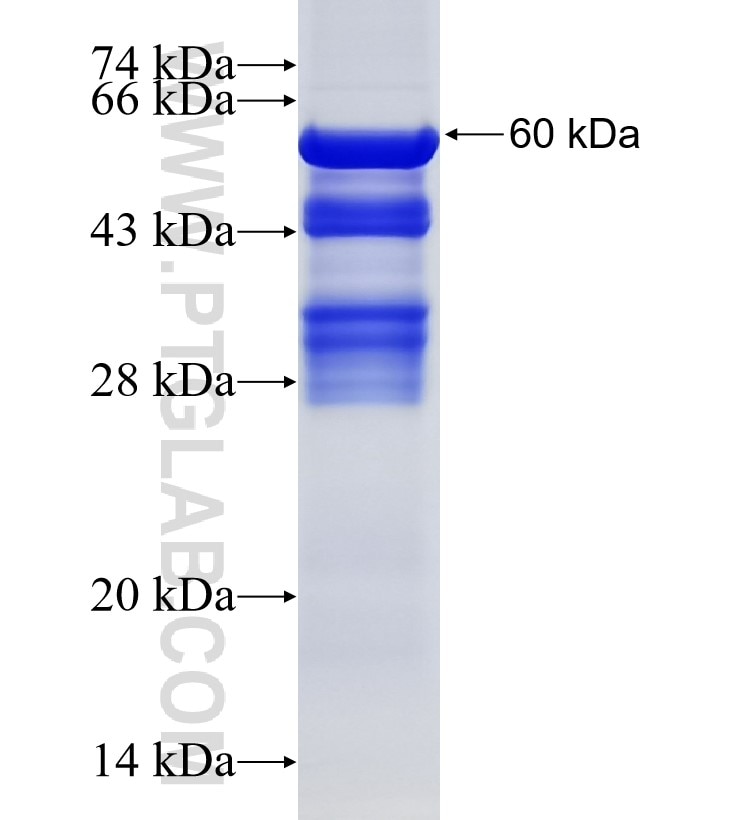 AUP1 fusion protein Ag4680 SDS-PAGE