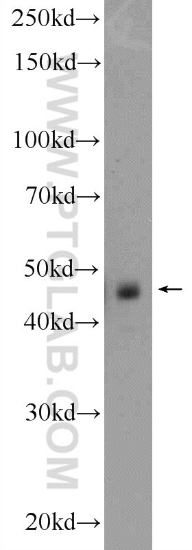 Aurora A Polyclonal antibody