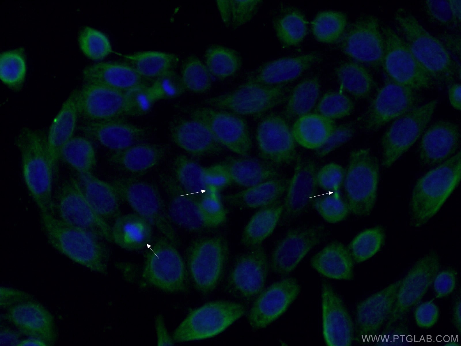 Immunofluorescence (IF) / fluorescent staining of HeLa cells using AURKA Monoclonal antibody (66757-1-Ig)