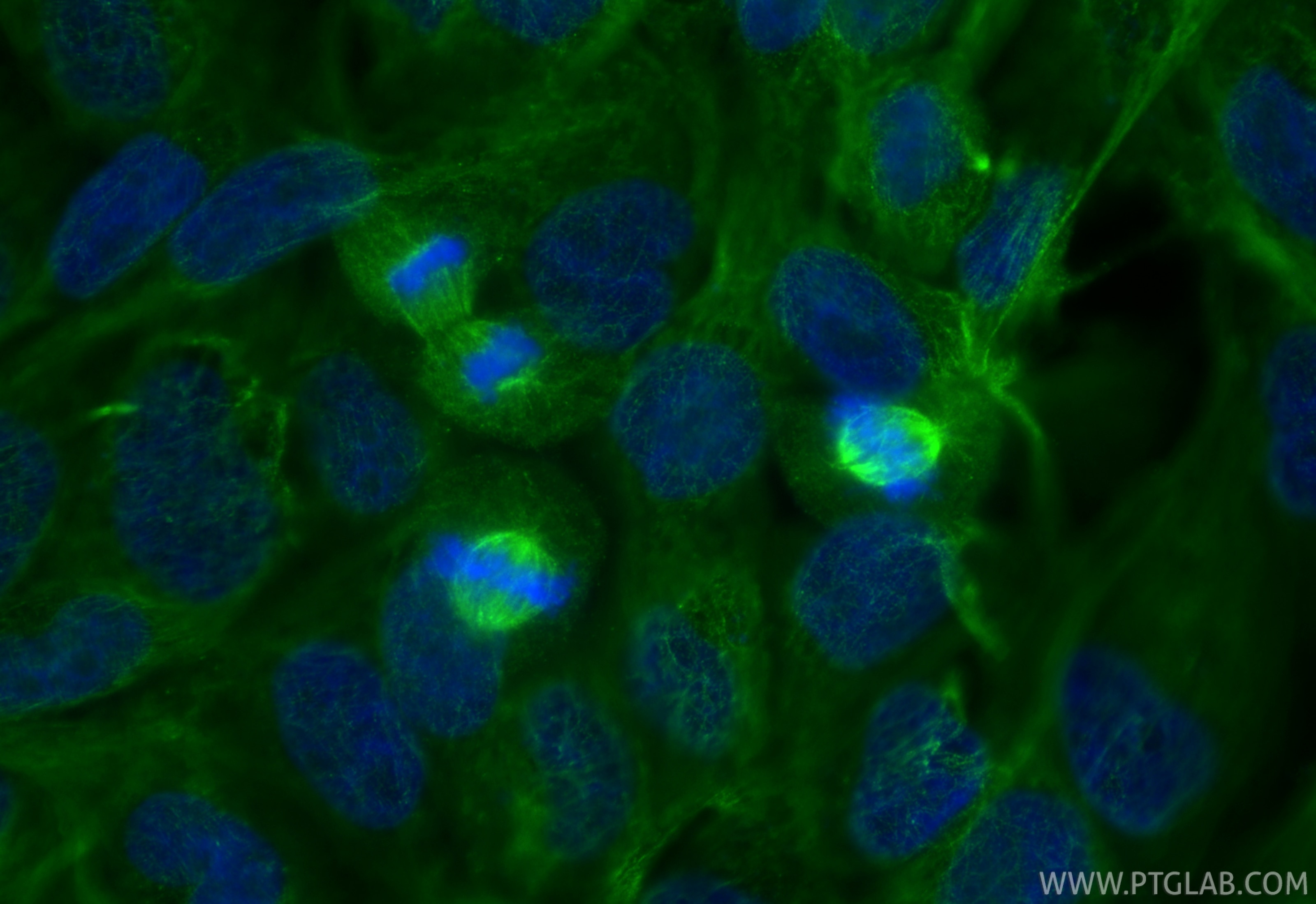 Immunofluorescent analysis of (4% PFA) fixed A431 cells using AURKA antibody (66757-1-Ig, Clone: 1F4B10 ) at dilution of 1:500 and CoraLite®488-Conjugated Goat Anti-Mouse IgG(H+L) (SA00013-1). Immunofluorescence (IF) / fluorescent staining of A431 cells using AURKA Monoclonal antibody (66757-1-Ig)
