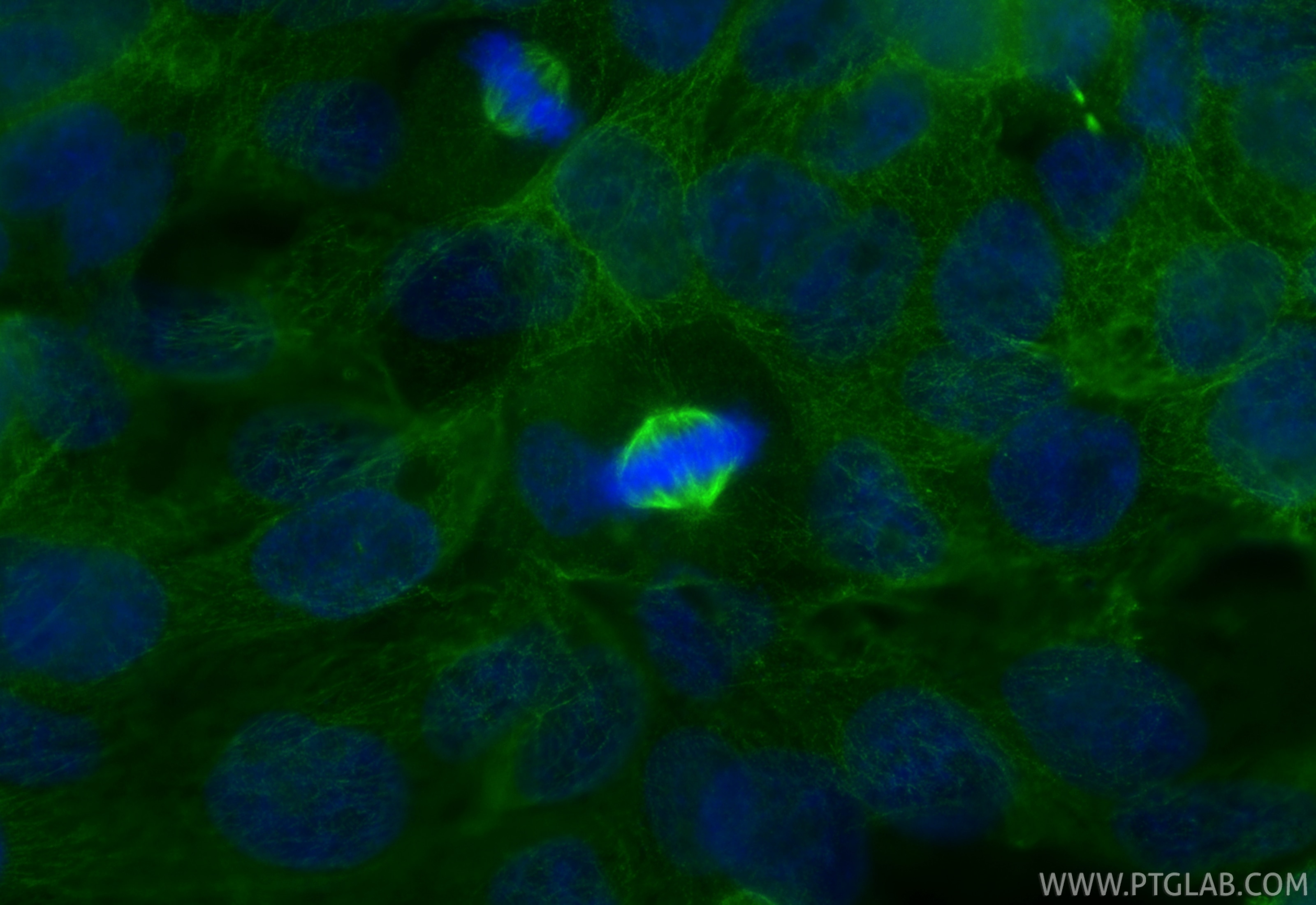 Immunofluorescent analysis of (4% PFA) fixed A431 cells using AURKA antibody (66757-1-Ig, Clone: 1F4B10 ) at dilution of 1:1000 and CoraLite®488-Conjugated Goat Anti-Mouse IgG(H+L) (SA00013-1). Immunofluorescence (IF) / fluorescent staining of A431 cells using AURKA Monoclonal antibody (66757-1-Ig)