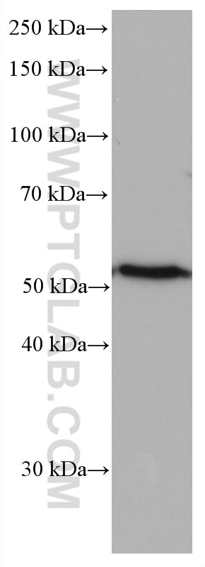 Western Blot (WB) analysis of NCCIT cells using AURKA Monoclonal antibody (66757-1-Ig)