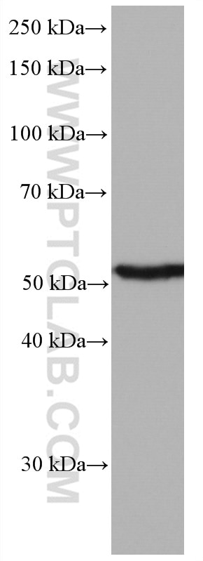 Western Blot (WB) analysis of human testis tissue using AURKA Monoclonal antibody (66757-1-Ig)