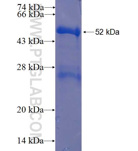 AURKA fusion protein Ag0362 SDS-PAGE