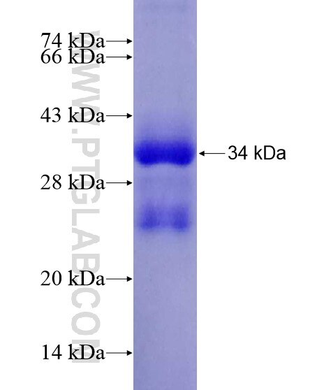 AURKA fusion protein Ag20096 SDS-PAGE
