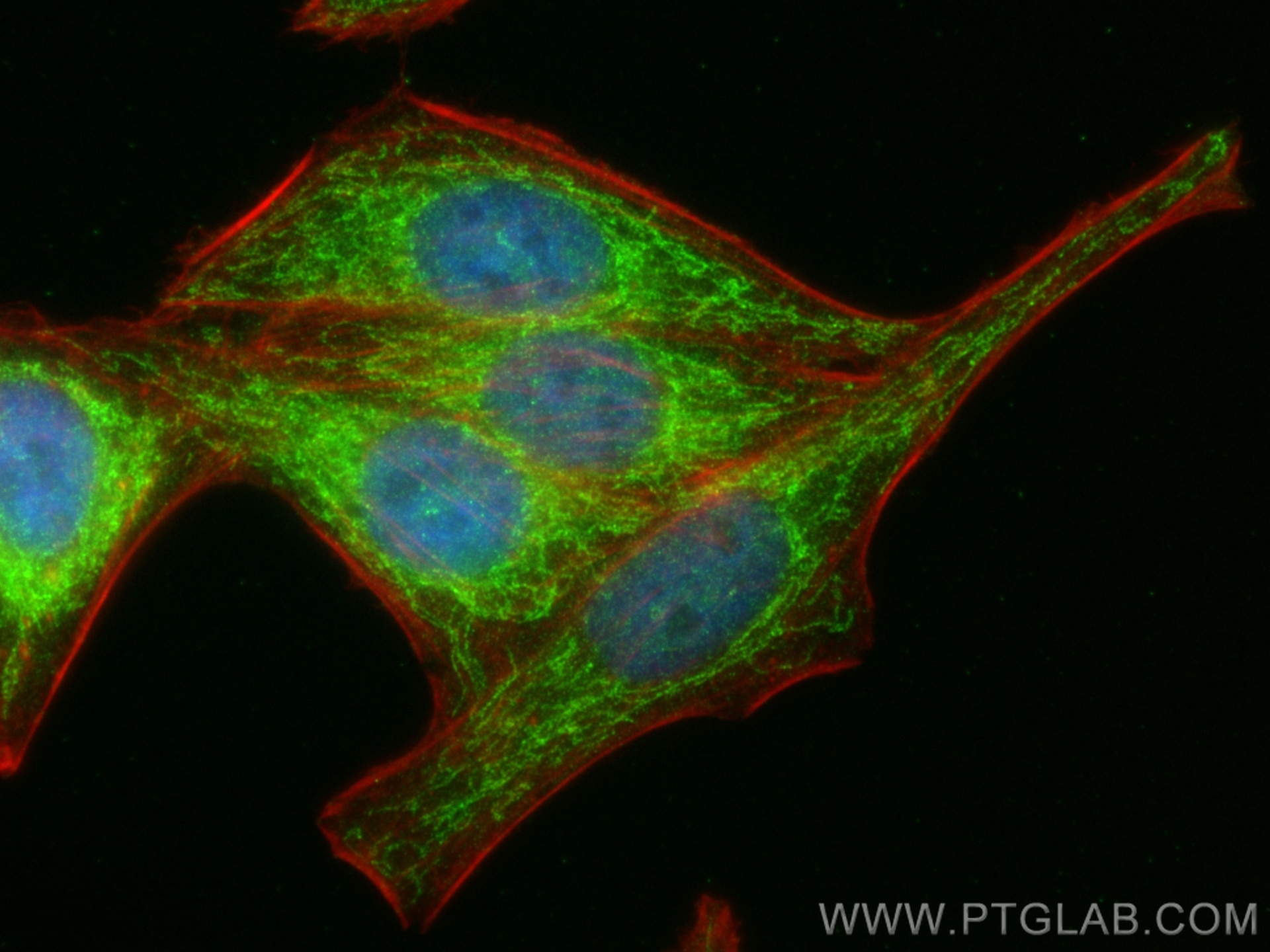 Immunofluorescence (IF) / fluorescent staining of HepG2 cells using AURKAIP1 Polyclonal antibody (17528-1-AP)