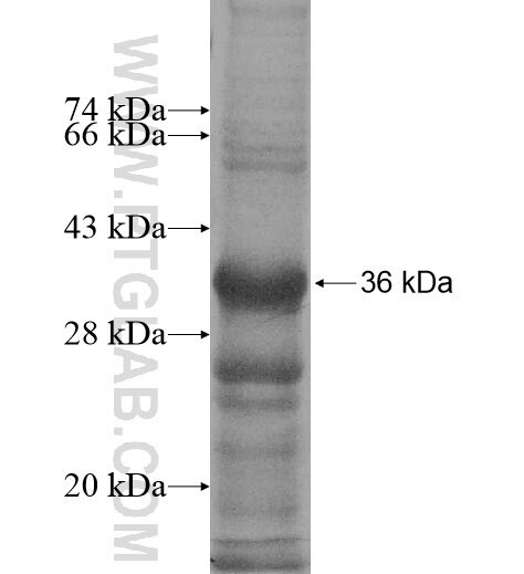 AURKAIP1 fusion protein Ag11540 SDS-PAGE