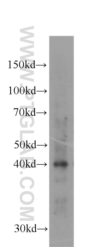 Western Blot (WB) analysis of HeLa cells using Aurora B Monoclonal antibody (60098-1-Ig)