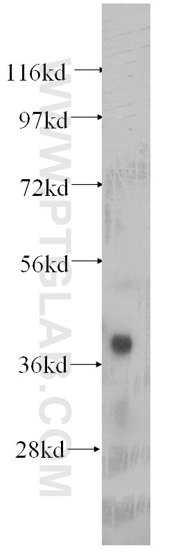 Western Blot (WB) analysis of mouse thymus tissue using Aurora B Monoclonal antibody (60098-1-Ig)