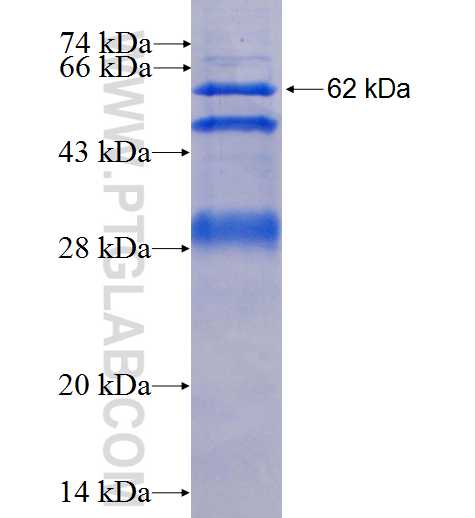 AURKB fusion protein Ag1246 SDS-PAGE