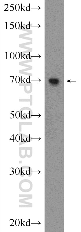 Western Blot (WB) analysis of C6 cells using AUTS2 Polyclonal antibody (25001-1-AP)