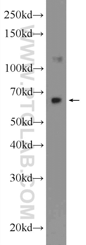 Western Blot (WB) analysis of NIH/3T3 cells using AUTS2 Polyclonal antibody (25001-1-AP)