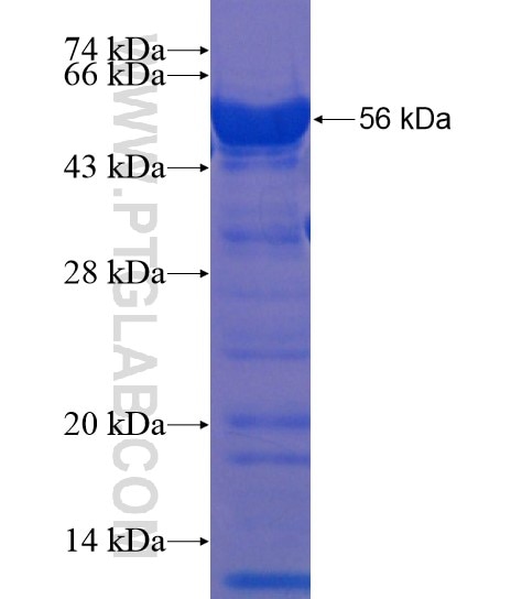 AUTS2 fusion protein Ag21853 SDS-PAGE