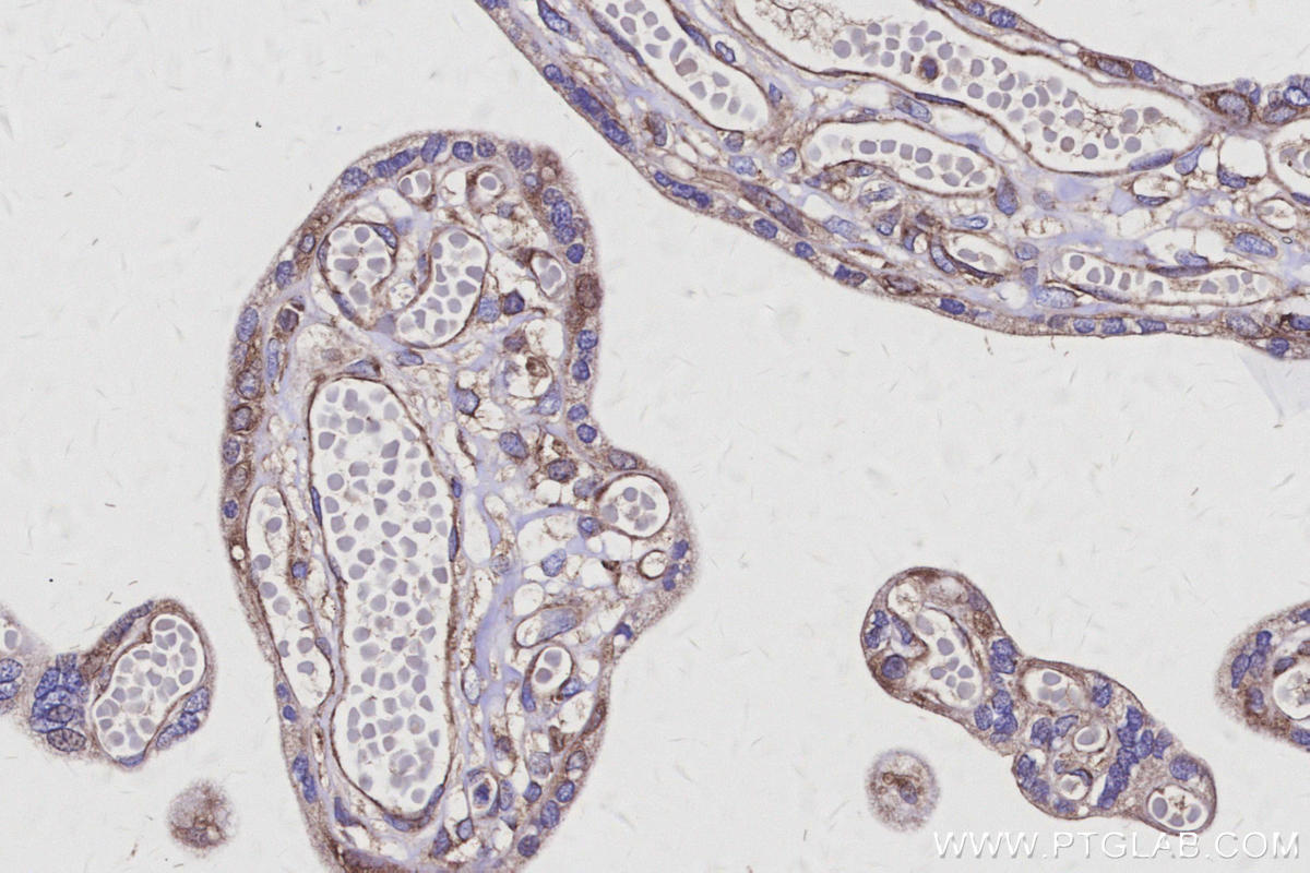 IHC staining of human placenta using 25846-1-AP Immunohistochemistry (IHC) staining of human placenta tissue using AVEN Polyclonal antibody (25846-1-AP)