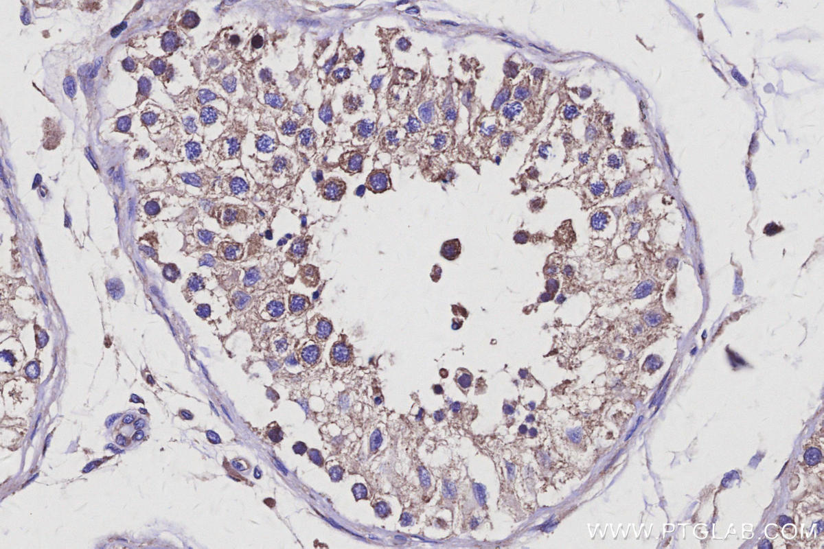 IHC staining of human testis using 25846-1-AP Immunohistochemistry (IHC) staining of human testis tissue using AVEN Polyclonal antibody (25846-1-AP)