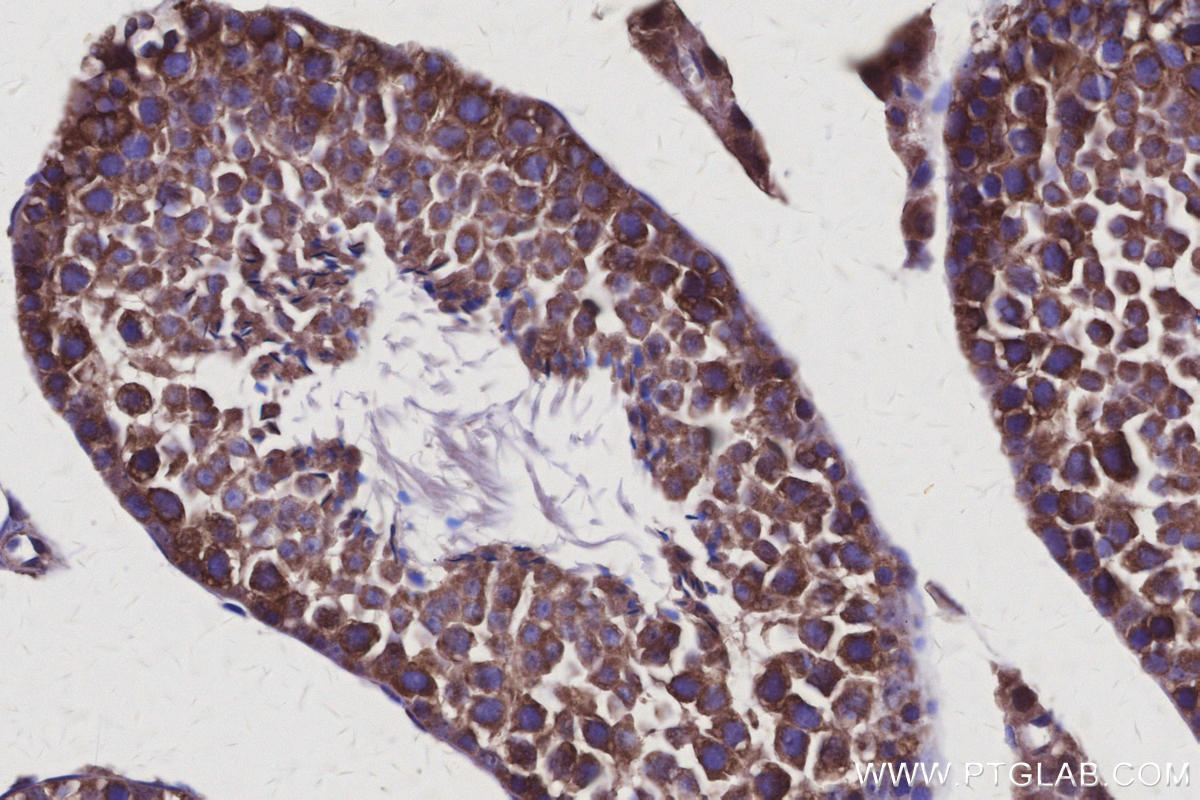 IHC staining of mouse testis using 25846-1-AP Immunohistochemistry (IHC) staining of mouse testis tissue using AVEN Polyclonal antibody (25846-1-AP)