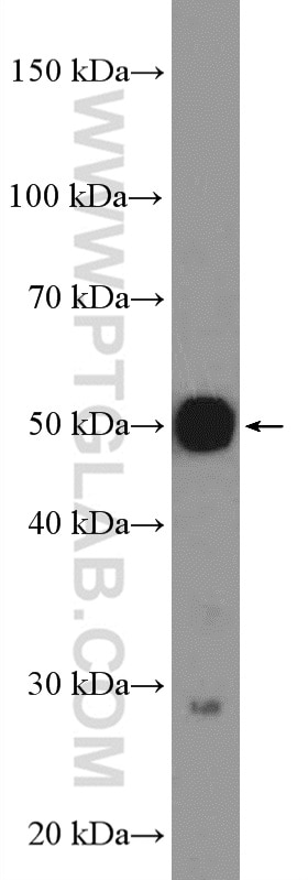 WB analysis of K-562 using 25846-1-AP