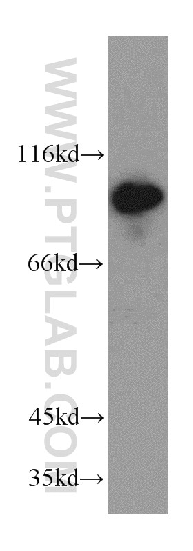 Western Blot (WB) analysis of mouse skin tissue using Advillin Polyclonal antibody (20956-1-AP)