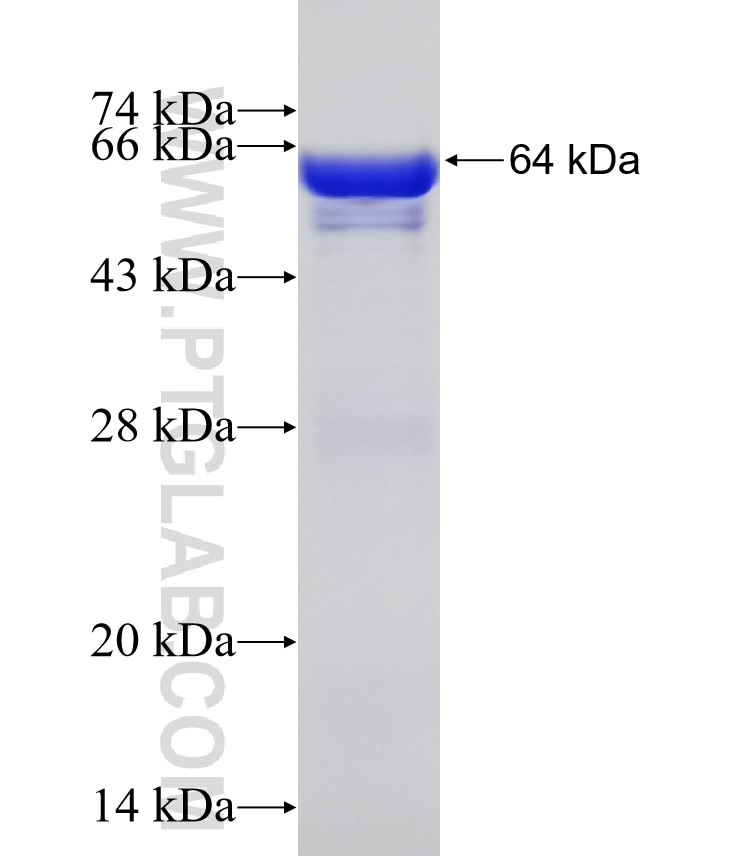 AVIL fusion protein Ag15114 SDS-PAGE
