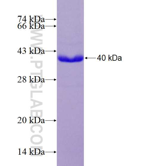 AVIL fusion protein Ag15247 SDS-PAGE