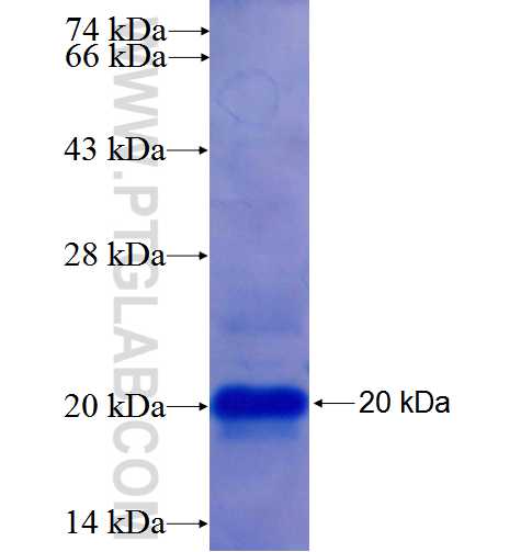 AVP fusion protein Ag25655 SDS-PAGE
