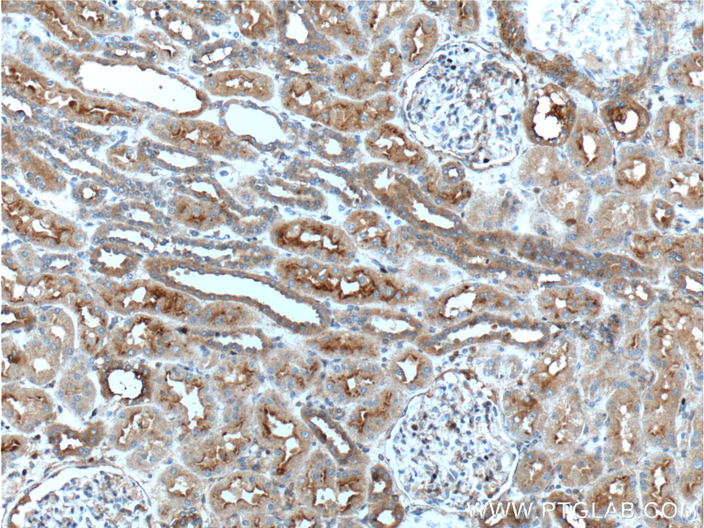 Immunohistochemistry (IHC) staining of human kidney tissue using AVPR1B Polyclonal antibody (55142-1-AP)