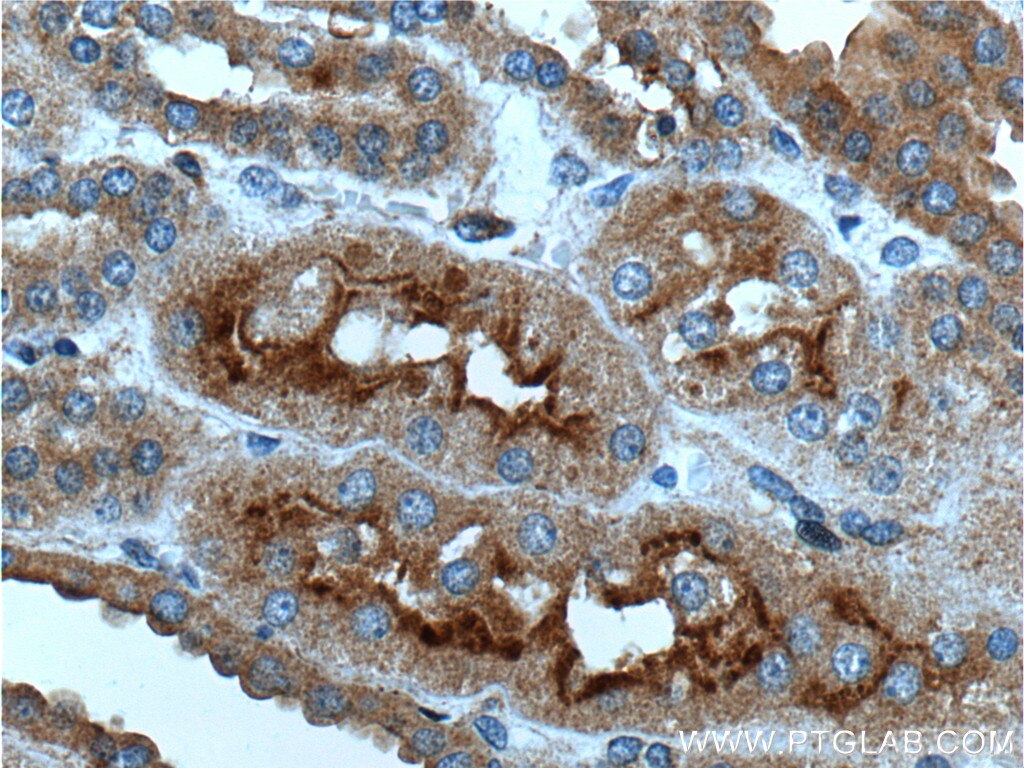 Immunohistochemistry (IHC) staining of human kidney tissue using AVPR1B Polyclonal antibody (55142-1-AP)