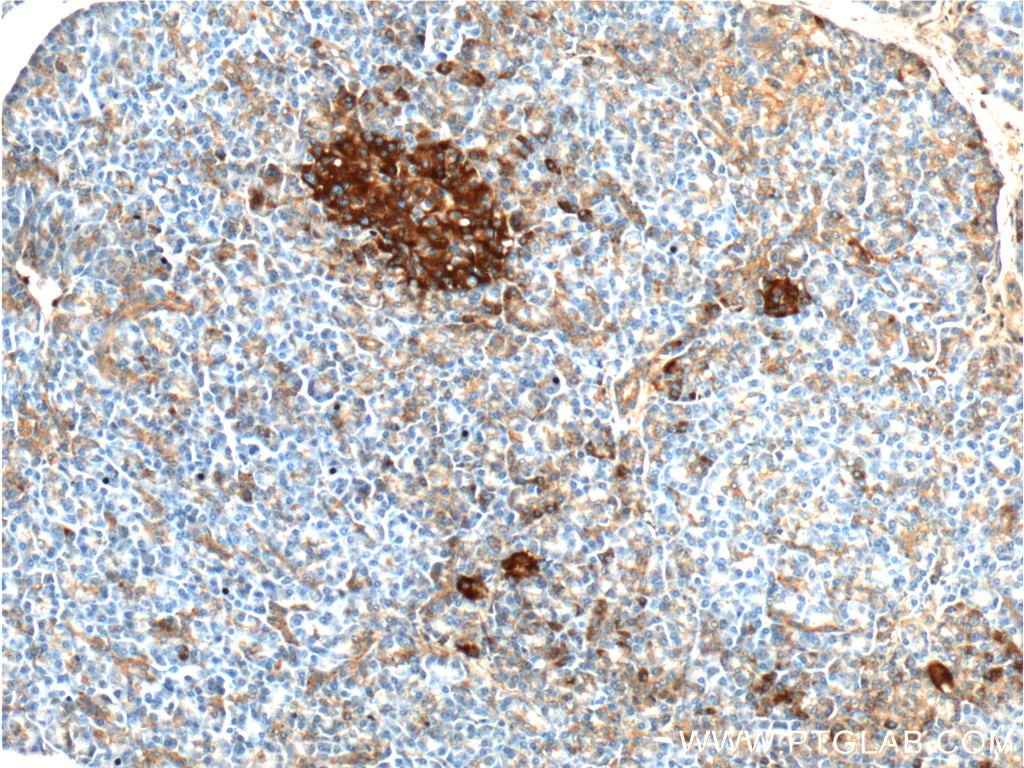 Immunohistochemistry (IHC) staining of human pancreas tissue using AVPR1B Polyclonal antibody (55142-1-AP)