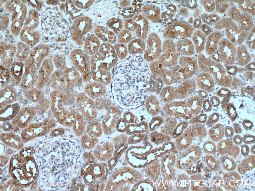 IHC staining of human kidney using 55142-1-AP