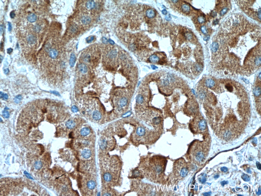 Immunohistochemistry (IHC) staining of human kidney tissue using AVPR1B Polyclonal antibody (55142-1-AP)