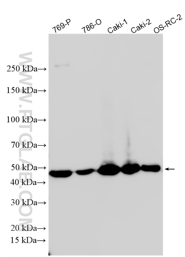 WB analysis using 27691-1-AP (same clone as 27691-1-PBS) Western Blot (WB) analysis of various lysates using AVPR2 Polyclonal antibody (27691-1-AP)