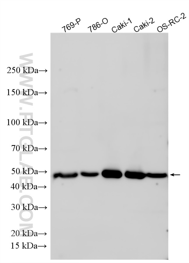 WB analysis using 27691-1-AP (same clone as 27691-1-PBS) Western Blot (WB) analysis of various lysates using AVPR2 Polyclonal antibody (27691-1-AP)