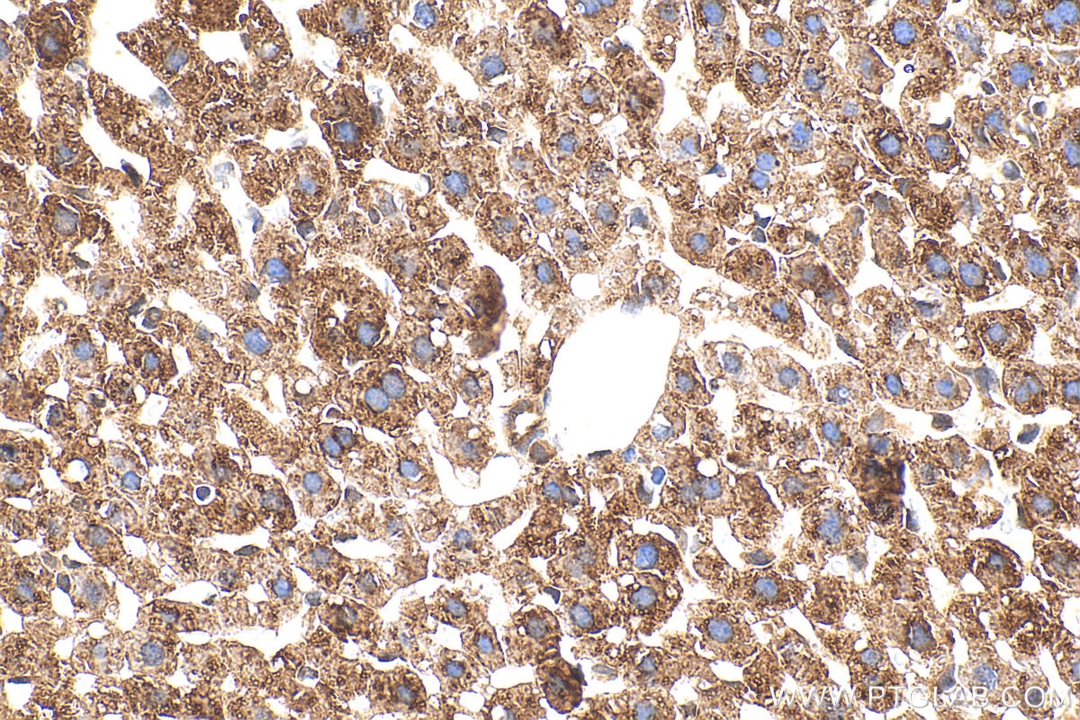 Immunohistochemistry (IHC) staining of mouse liver tissue using AWAT1 Polyclonal antibody (24704-1-AP)