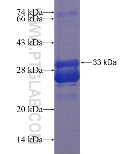 AWAT1 fusion protein Ag20183 SDS-PAGE