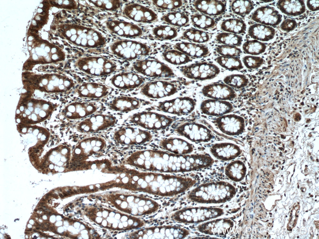 Immunohistochemistry (IHC) staining of human colon tissue using AXIN1 Polyclonal antibody (16541-1-AP)