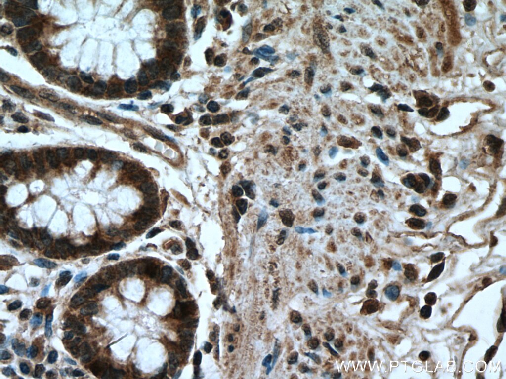 Immunohistochemistry (IHC) staining of human colon tissue using AXIN1 Polyclonal antibody (16541-1-AP)