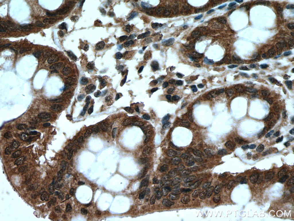 Immunohistochemistry (IHC) staining of human colon tissue using AXIN1 Polyclonal antibody (16541-1-AP)