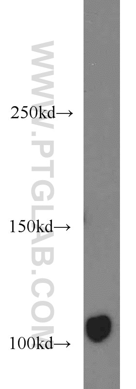 Western Blot (WB) analysis of HT-1080 cells using AXIN1 Polyclonal antibody (16541-1-AP)