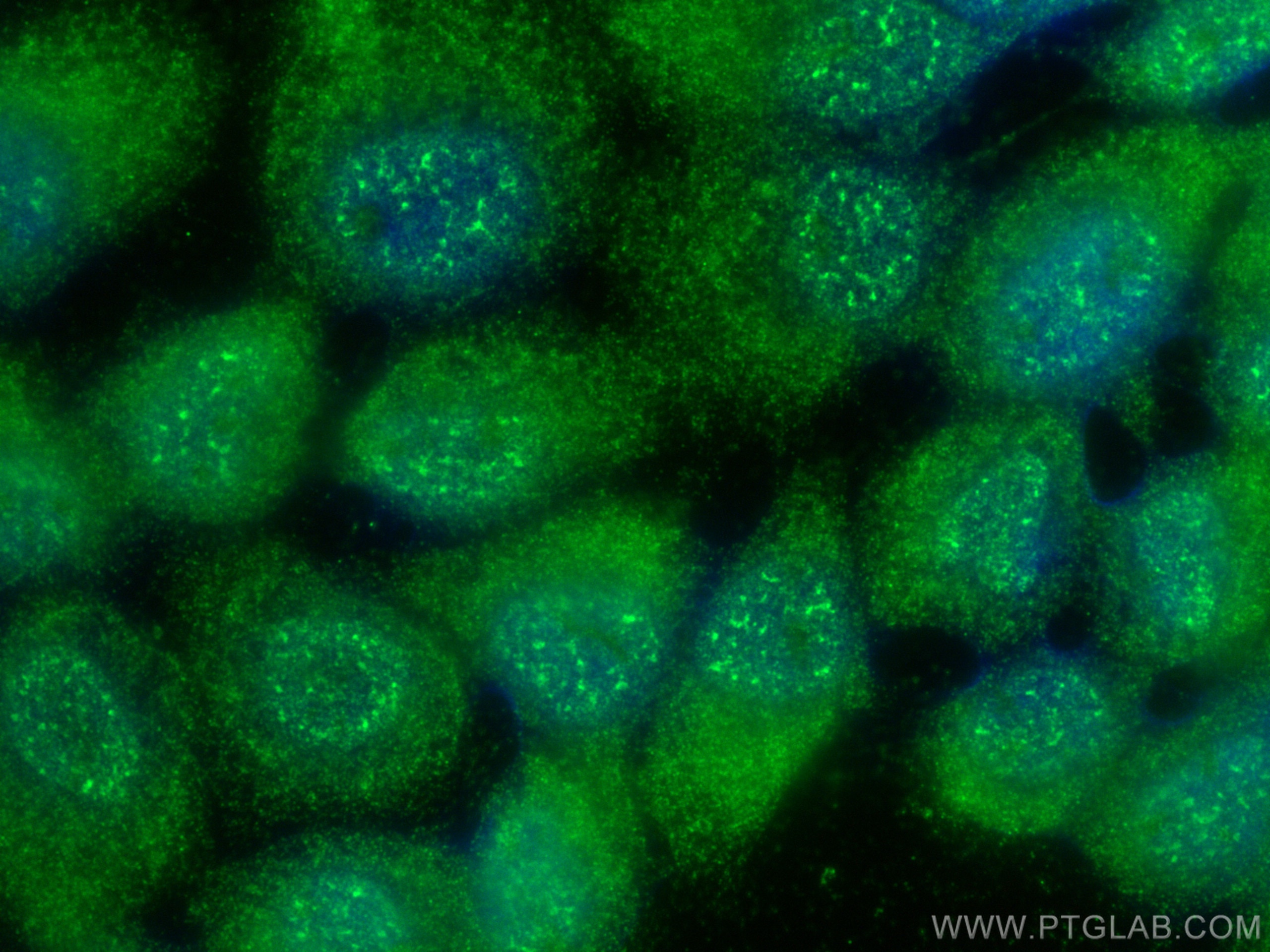 Immunofluorescence (IF) / fluorescent staining of A431 cells using AXIN1 Monoclonal antibody (68093-1-Ig)
