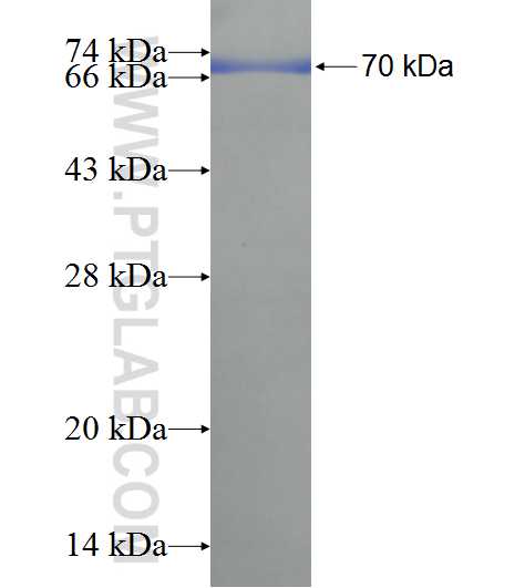 AXIN1 fusion protein Ag9858 SDS-PAGE