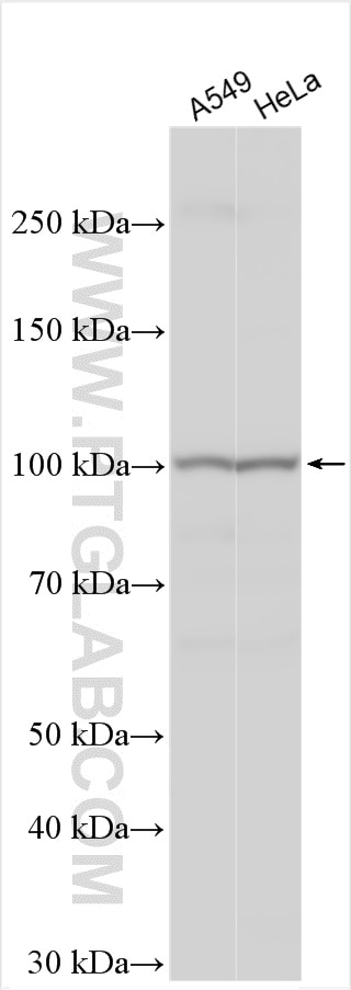 Western Blot (WB) analysis of various lysates using AXIN2 Polyclonal antibody (20540-1-AP)