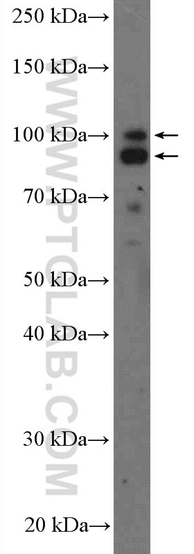 Western Blot (WB) analysis of Jurkat cells using AXIN2 Polyclonal antibody (20540-1-AP)