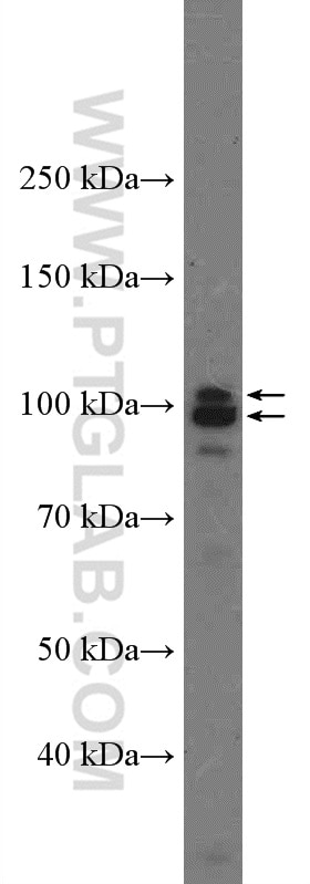 Western Blot (WB) analysis of MDA-MB-453s cells using AXIN2 Polyclonal antibody (20540-1-AP)