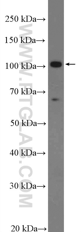 WB analysis of BxPC-3 using 20540-1-AP