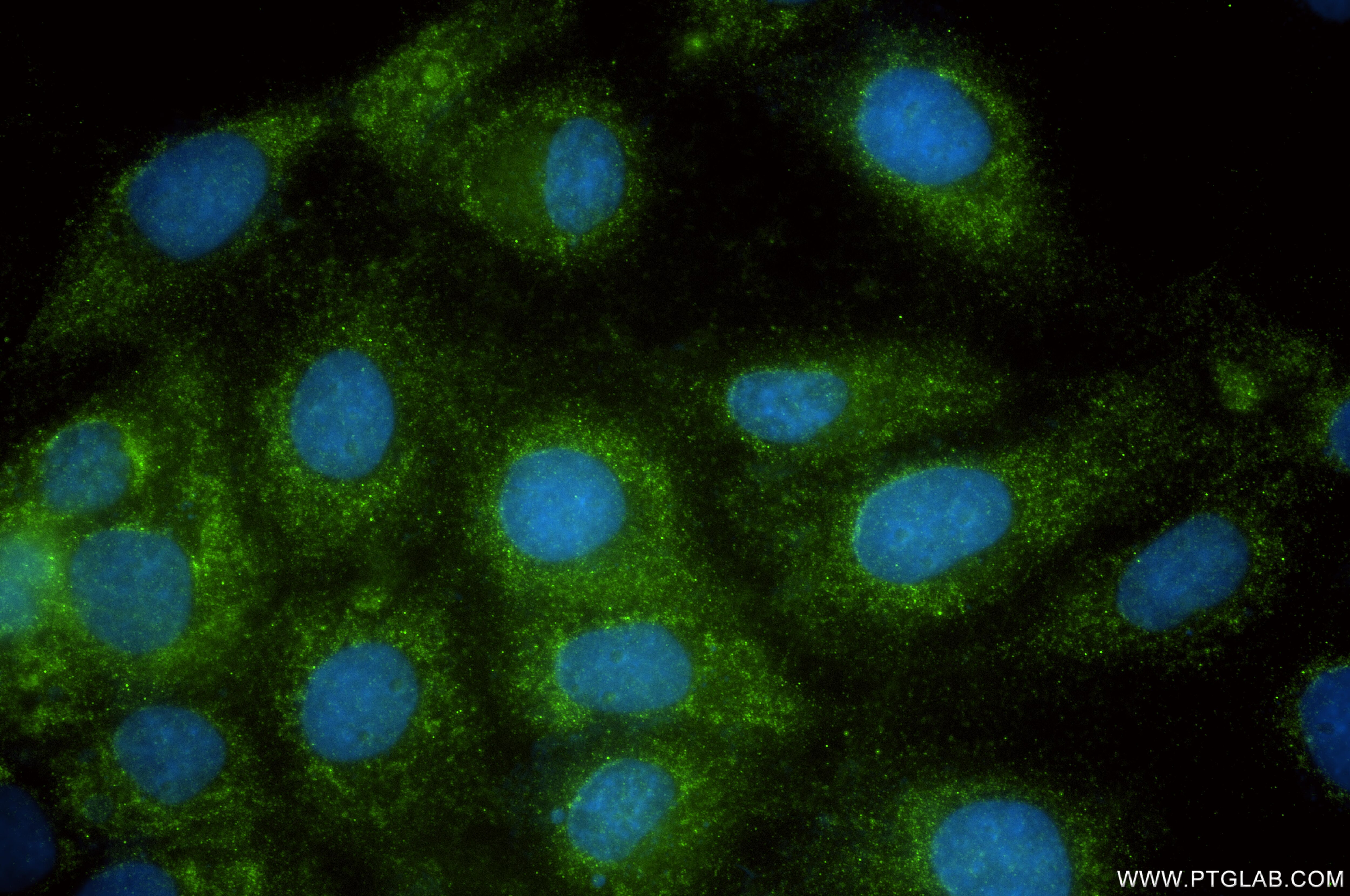 IF Staining of A431 using 83631-2-RR Immunofluorescence (IF) / fluorescent staining of A431 cells using AXIN2 Recombinant monoclonal antibody (83631-2-RR)