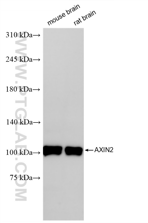 WB analysis using 83631-2-RR Western Blot (WB) analysis of various lysates using AXIN2 Recombinant monoclonal antibody (83631-2-RR)