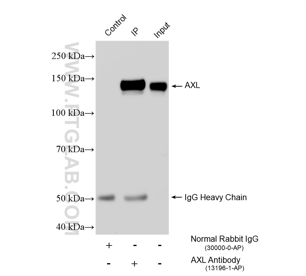 Immunoprecipitation (IP) experiment of HeLa cells using AXL Polyclonal antibody (13196-1-AP)