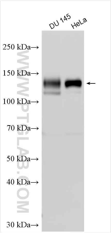 Western Blot (WB) analysis of various lysates using AXL Polyclonal antibody (13196-1-AP)