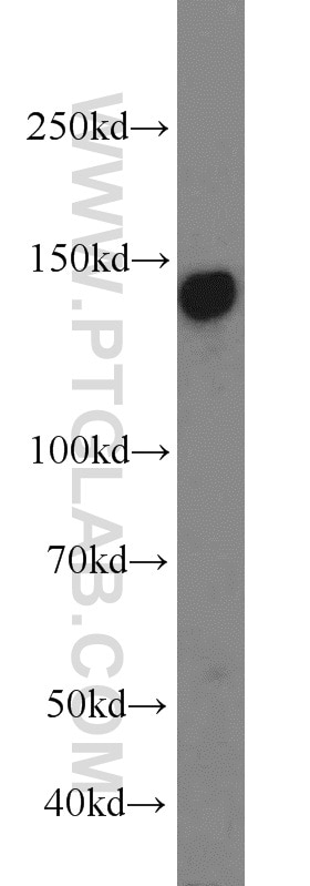 Western Blot (WB) analysis of HepG2 cells using AXL Polyclonal antibody (13196-1-AP)